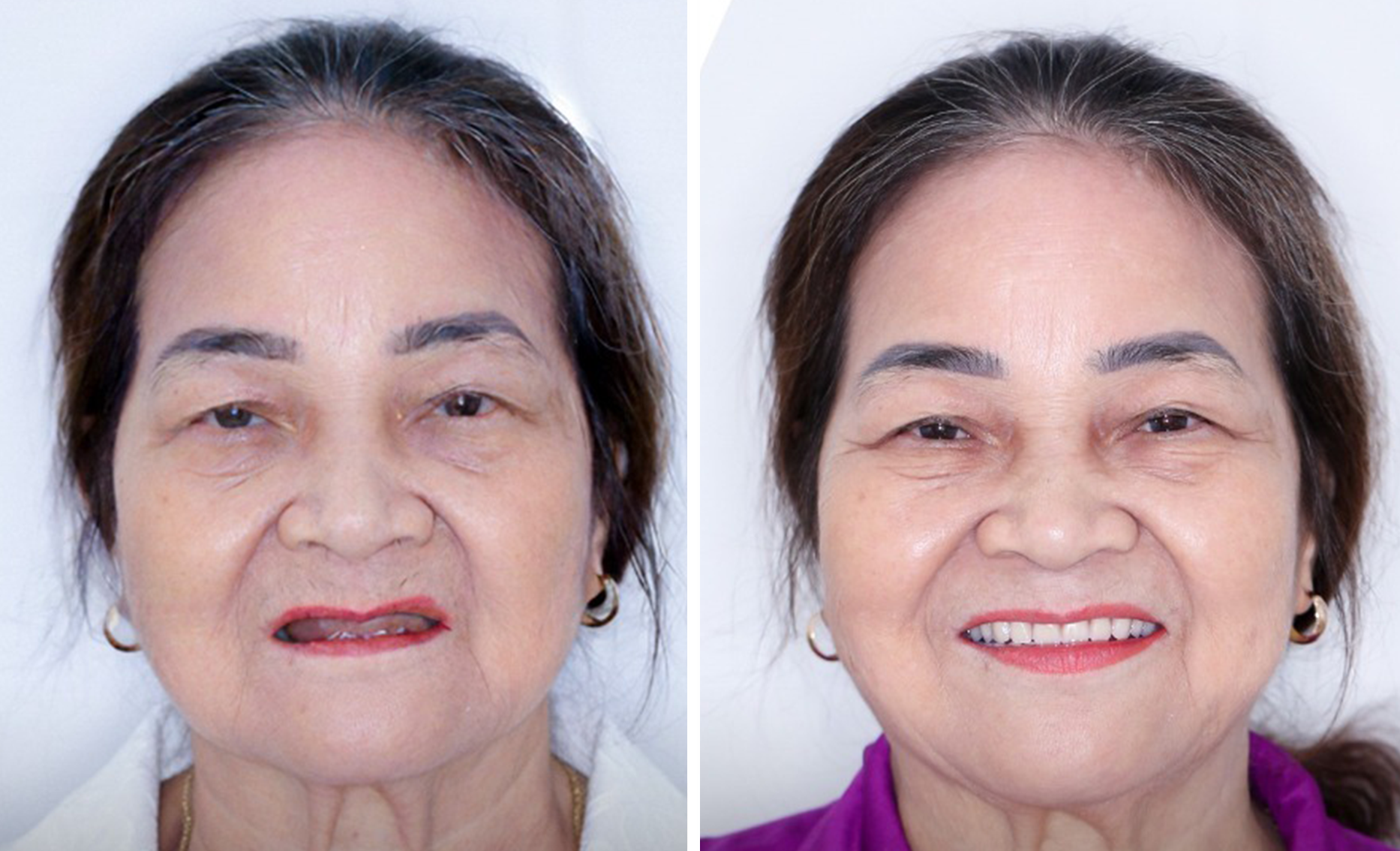 MS Thanh Tú